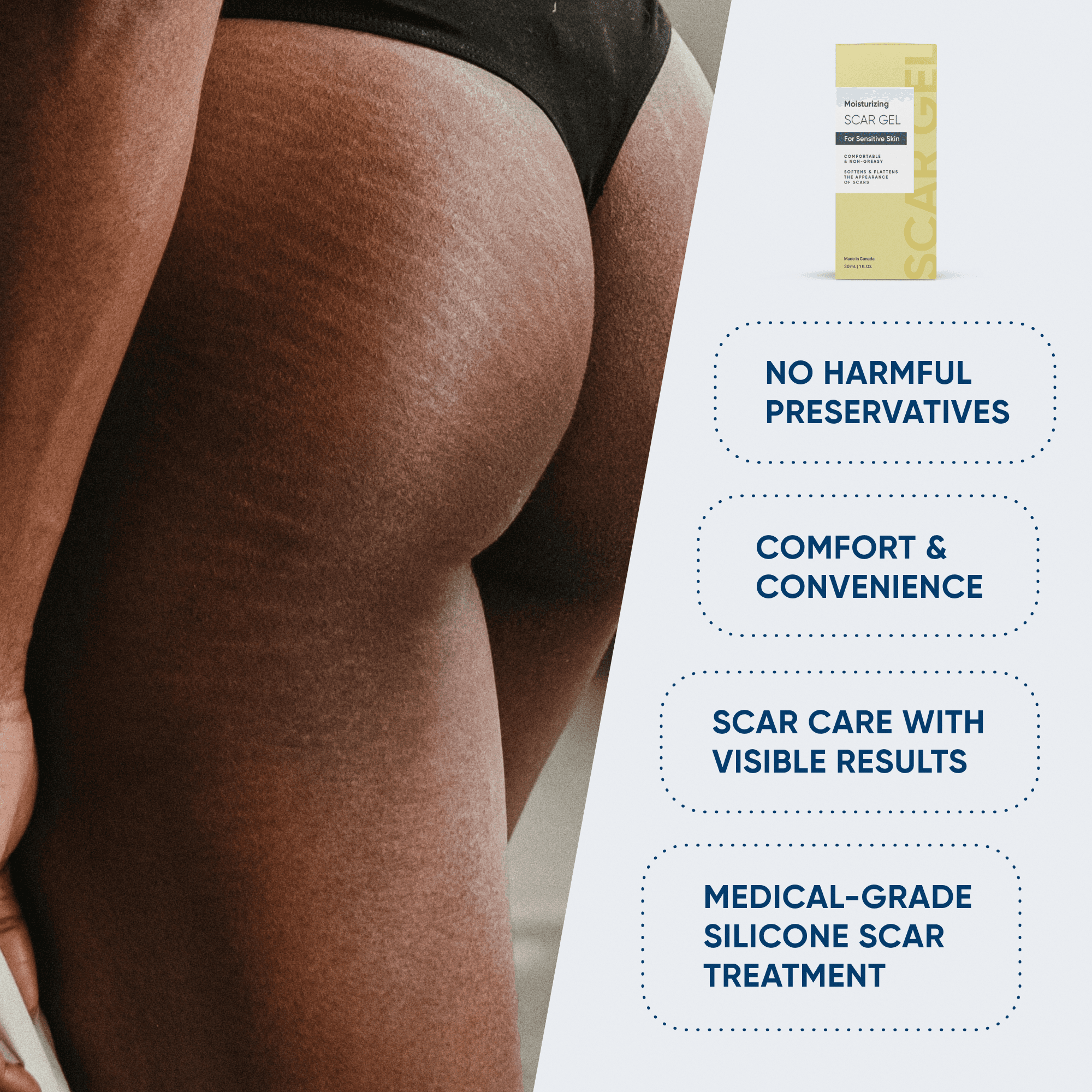 Scar Gel: no harmful preservatives, scar care with visible results, medical-grade silicone