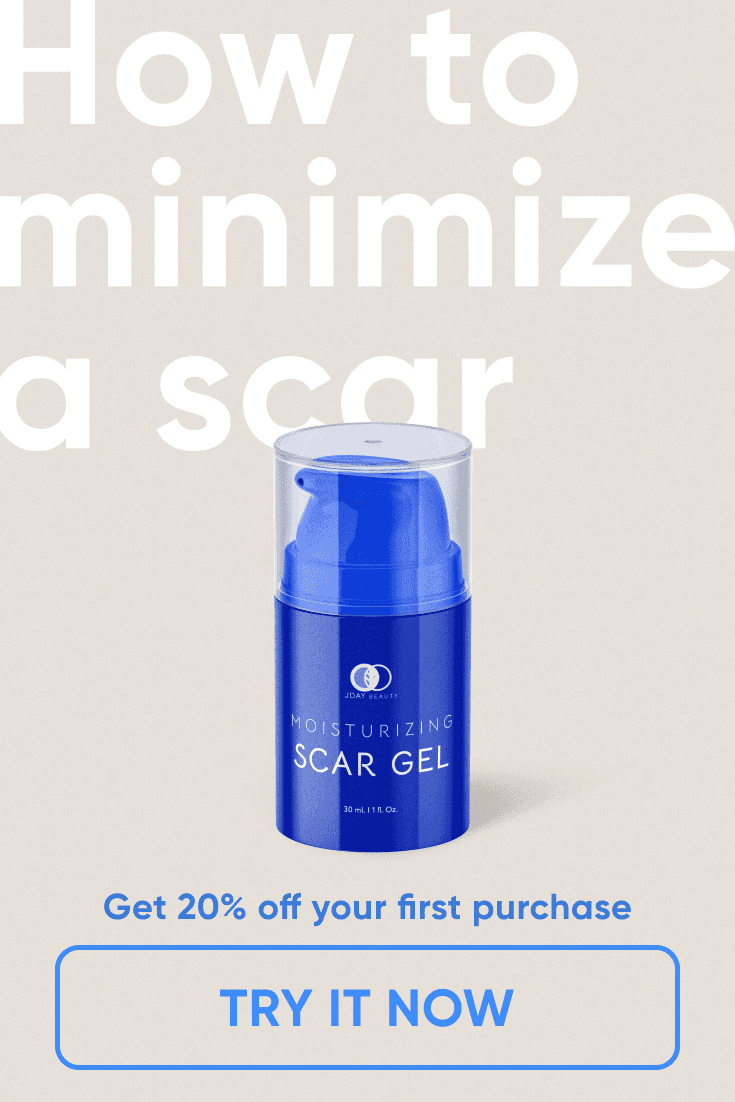 Scar Gel ad: How to minimize a scar, 20% off your first purchase