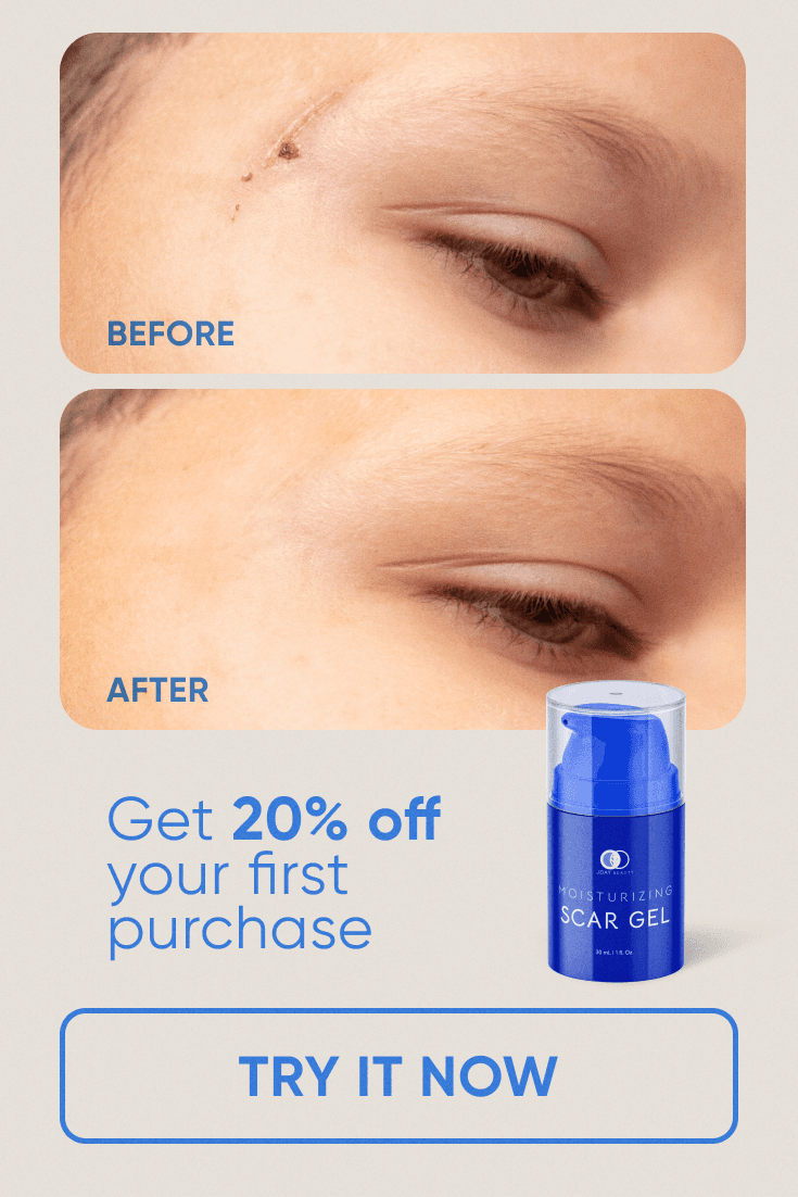Scar Gel ad: a scar by an eye before and after, 20% off your first purchase