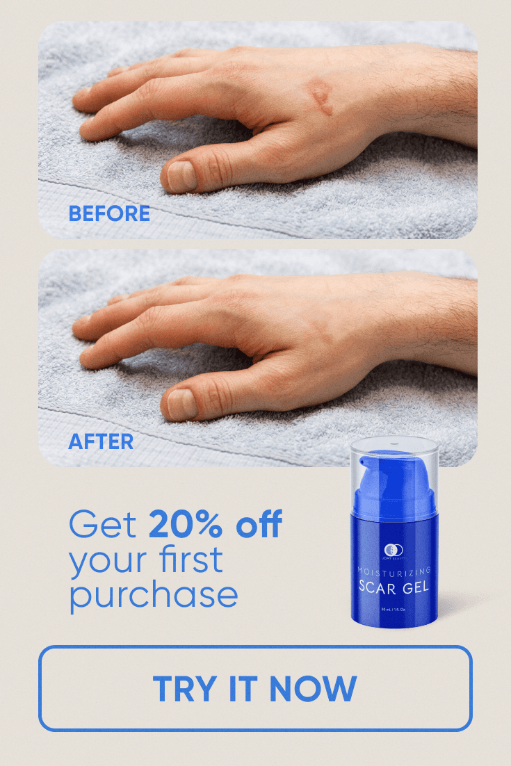 Scar Gel ad: a scar on a hand before and after, 20% off your first purchase