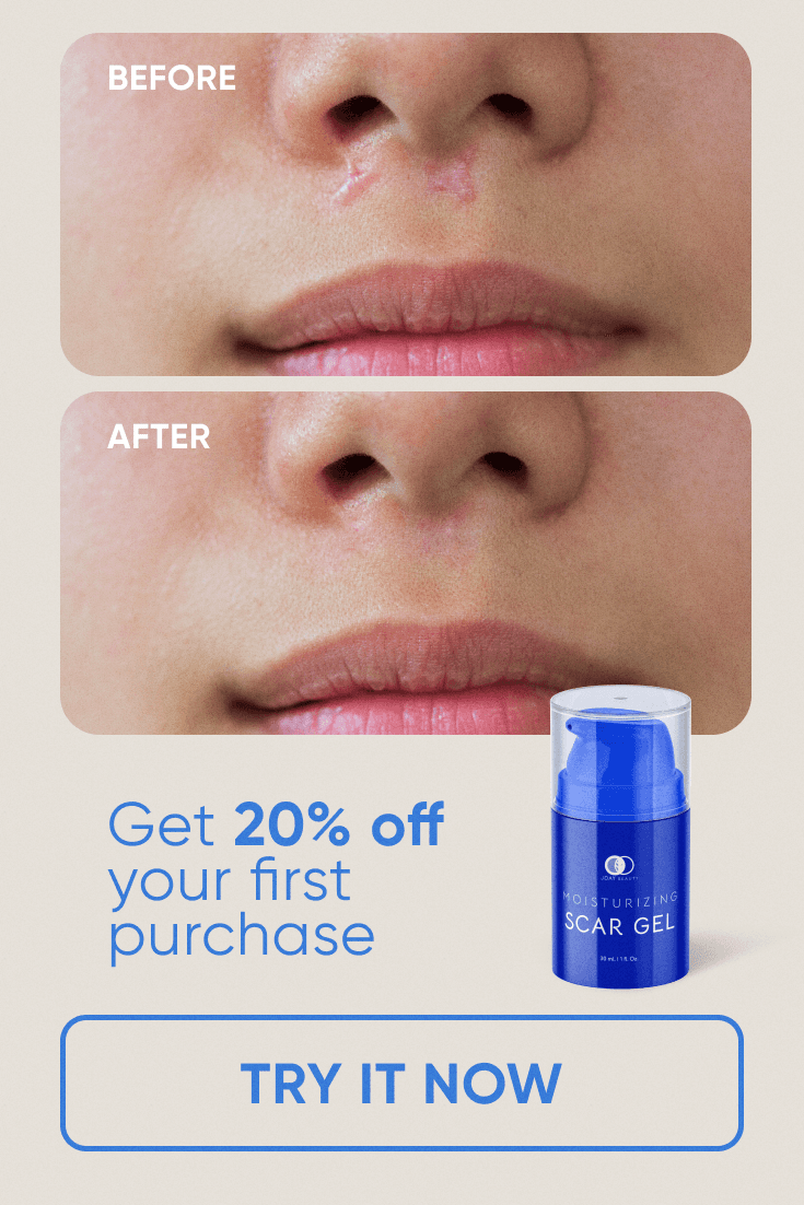 Scar Gel ad: a scar above a lip before and after, 20% off your first purchase